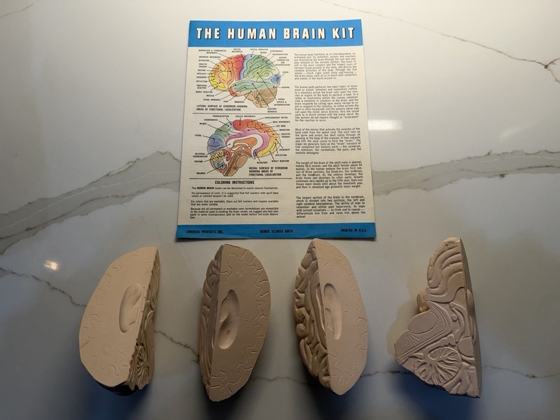 Rare- Vintage 1973 The Human Brain- Anatomically Accurate Kit- The Lindberg Line gallery