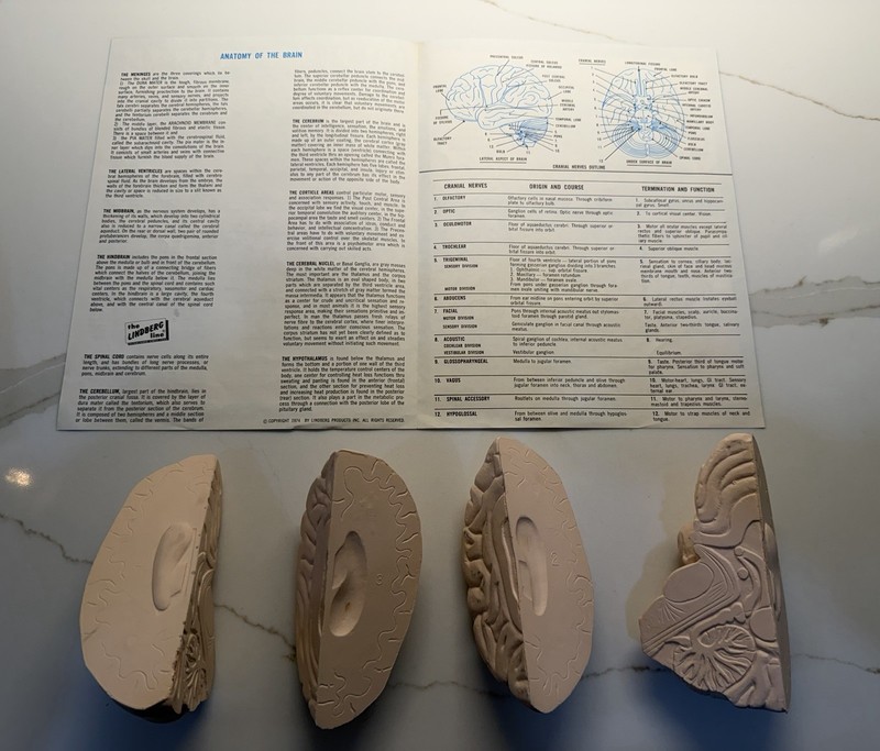 Rare- Vintage 1973 The Human Brain- Anatomically Accurate Kit- The Lindberg Line gallery